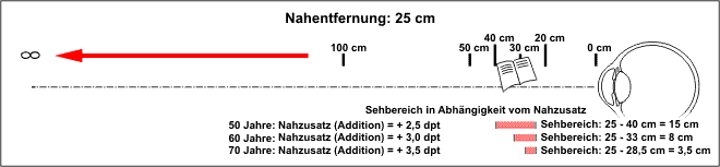 ak25cm